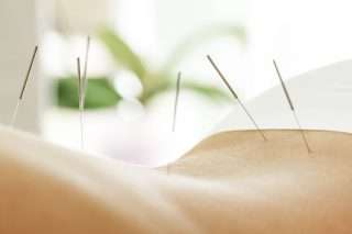 Acupuncture For Sciatic